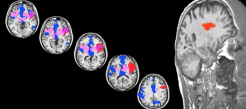 brain