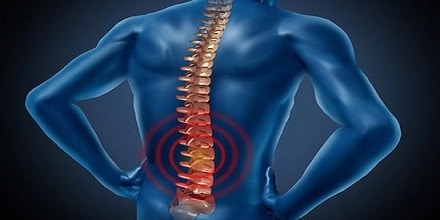 تفاوت دیسک کمر و سیاتیک