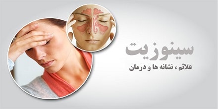 سینوزیت و چگونی درمان آن